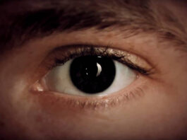 yeux-iris-aniridie