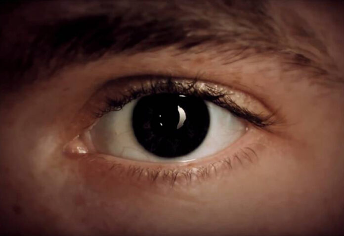 yeux-iris-aniridie